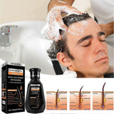 Frombo Advanced Hair Growth Shampoo – Biotin & DHT Blocker for Thicker, Stronger & Healthier Hair (250ml)